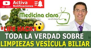 LIMPIEZAS VESICULA BILIAR ¿Qué son las PIEDRAS VERDES que se botan EXPLICACION  Medicina Clara [upl. by Enilada665]