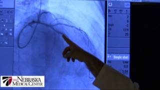 Cardiac Catheterization What You Can Expect [upl. by Veronika]