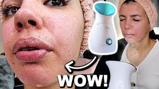 I Tested The Best FACIAL STEAMER On Amazon [upl. by Cathryn]