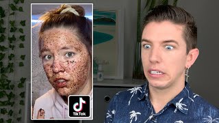 Specialist Reacts to Skin Care TikTok FAILS [upl. by Odeen]