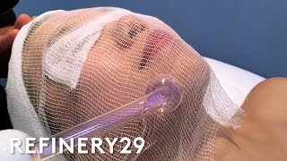 High Frequency Facial For Clear Skin  Beauty With Mi  Refinery29 [upl. by Elad]