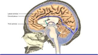 Subarachnoid Hemorrhage SAH Computed Tomography Scan Findings [upl. by Gilboa166]