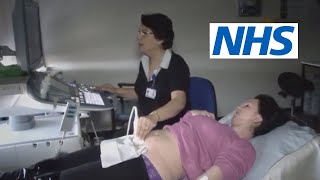 What happens at a scan and what will they tell me  NHS [upl. by Miguel]