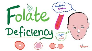 Folate deficiency  Megaloblastic Anemia  Macrocytic  Hematology Series [upl. by Ahsital]