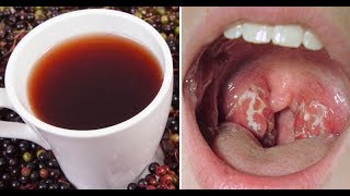 Sore Throat Which is Better Cold or Hot  Dr Alan Mandell DC [upl. by Allez13]