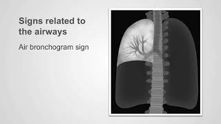 Introducing the InterTherm T HME from Intersurgical [upl. by Alemac]