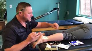 Iontophoresis in Physical Therapy [upl. by Nacnud327]