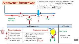 Antepartum hemorrhage  part 1 [upl. by Ramses]