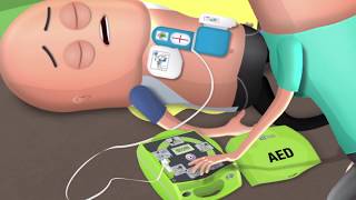 What is a cardiac arrest [upl. by Sivia]