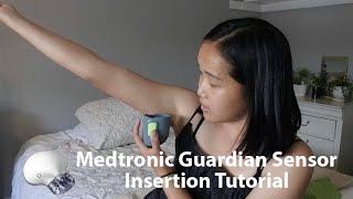 MEDTRONIC GUARDIAN SENSOR INSERTION TUTORIAL [upl. by Subak]