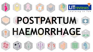 Prevention and Treatment of Postpartum Haemorrhage [upl. by Mauer]