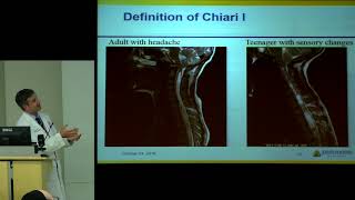 Pectoral anatomia y estiramiento [upl. by Clement]