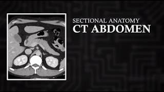 CT Cross Sectional Anatomy Abdomen Axial View [upl. by Arahd359]