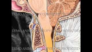 Anatomía Pectoral Mayor Características [upl. by Tomkin]