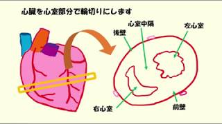 C ８冠動脈血流basic [upl. by Ahsitnauq]