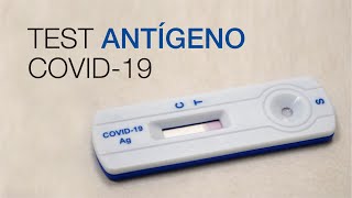 Test Antígeno COVID19 Clínica CEMTRO [upl. by Truitt]