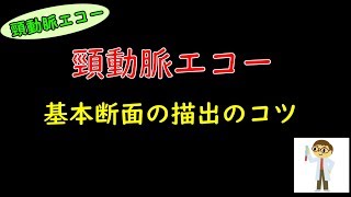 【頸動脈エコー】基本的な出し方と血管の走行。 [upl. by Horton386]