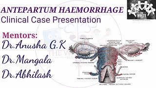 ANTEPARTUM HEAMORRHAGE Clinical Case Presentation [upl. by Ulu]