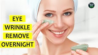 How to Cover Dark Circles  Under Eye Bags [upl. by Cralg781]