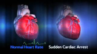 Post Cardiac Arrest  ACLS Review [upl. by Jackie606]