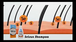 Selsun AntiDandruff Shampoo [upl. by Glynnis]