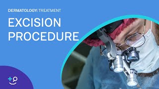 Excision Overview and Procedure Dermatology [upl. by Aiem254]