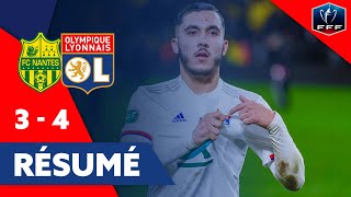 Résumé Nantes  OL  Coupe de France  Olympique Lyonnais [upl. by Ahtaela]