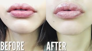 HOW TO GET BIGGER LIPS NATURALLY WITHOUT MAKEUP [upl. by Esmaria]