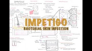 Impetigo Bacterial Skin Infection  Overview Clinical Presentation Pathophysiology Treatment [upl. by Stag]