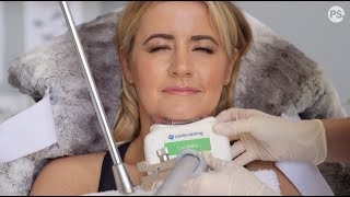 My Coolsculpting Fat Freeze Experience  Is it worth the money [upl. by Yelwah]