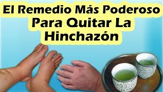 REMEDIOS CASEROS PARA LA HINCHAZÓN DE LOS PIES Como Desinflamar Los Pies Tobillos y Piernas [upl. by Lonee812]